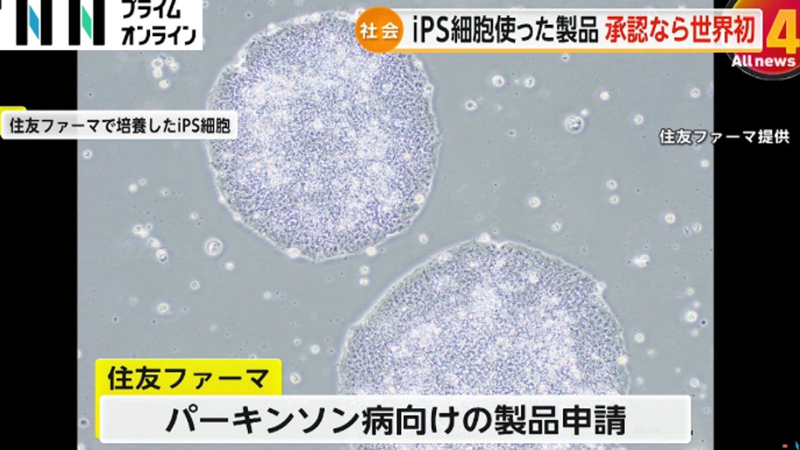 Japan's First iPS Cell Therapy Approval in 2026: What Does It Really Mean?